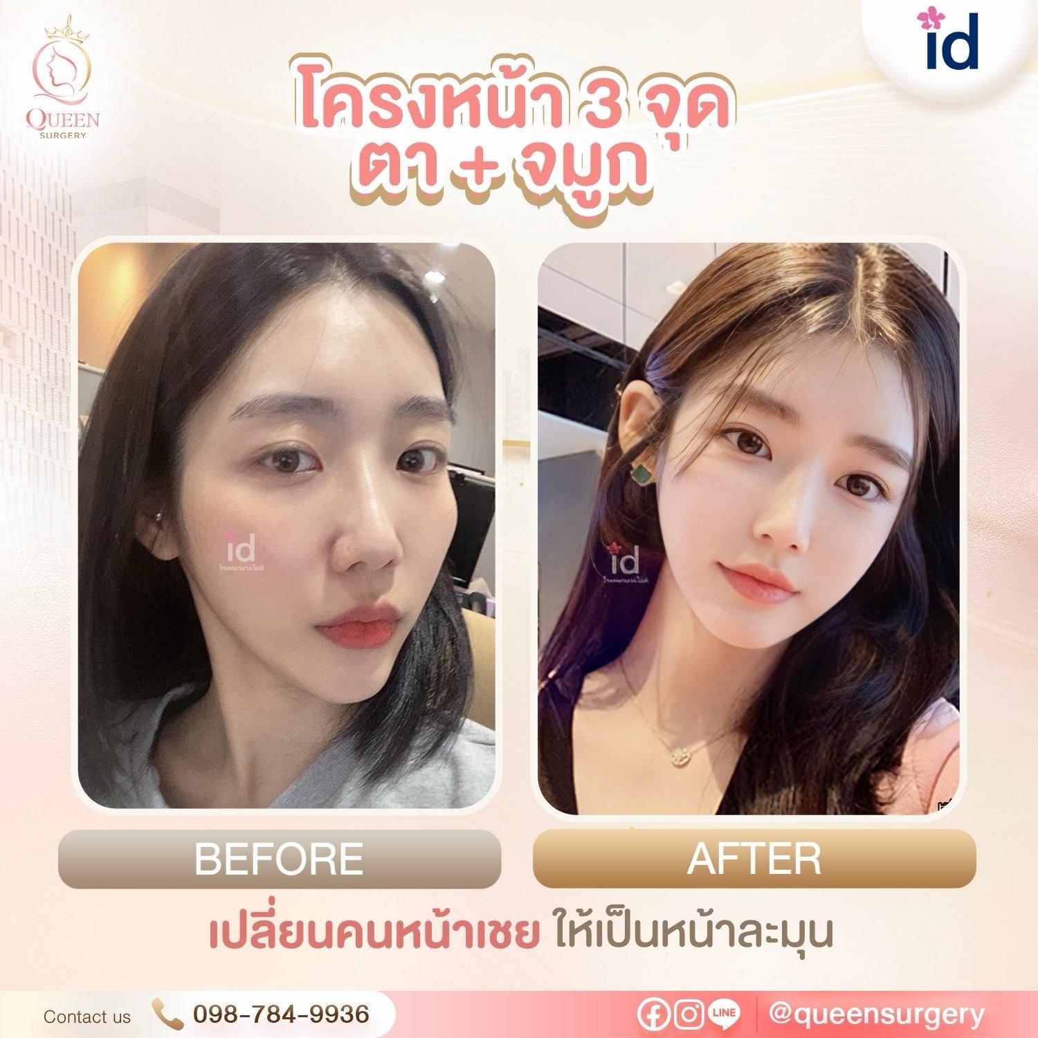 รีวิวการทำหน้าที่เกาหลี ปรับรูปหน้าและย้อนวัยสวยละมุนแบบธรรมชาติ