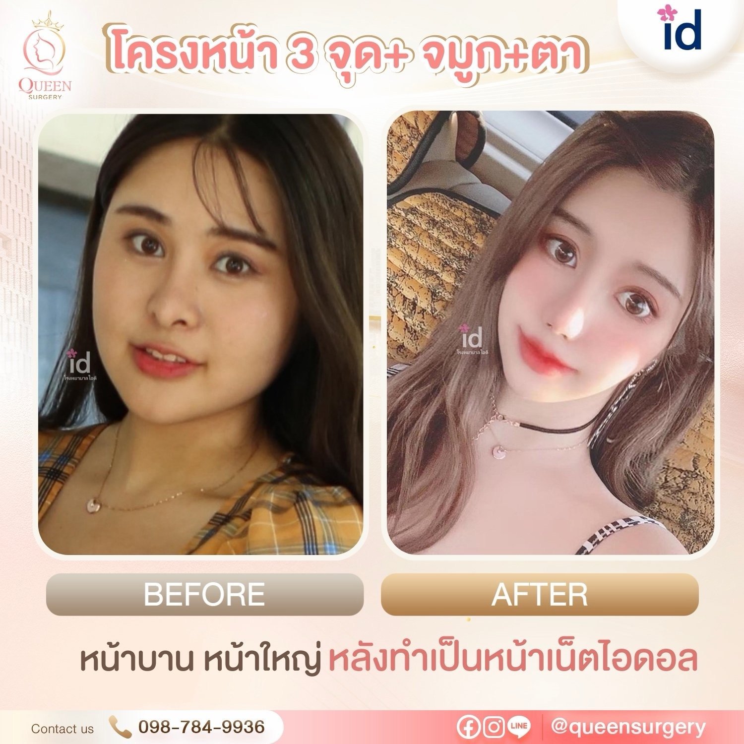 รีวิวการทำหน้าที่เกาหลี ปรับรูปหน้าและย้อนวัยสวยละมุนแบบธรรมชาติ
