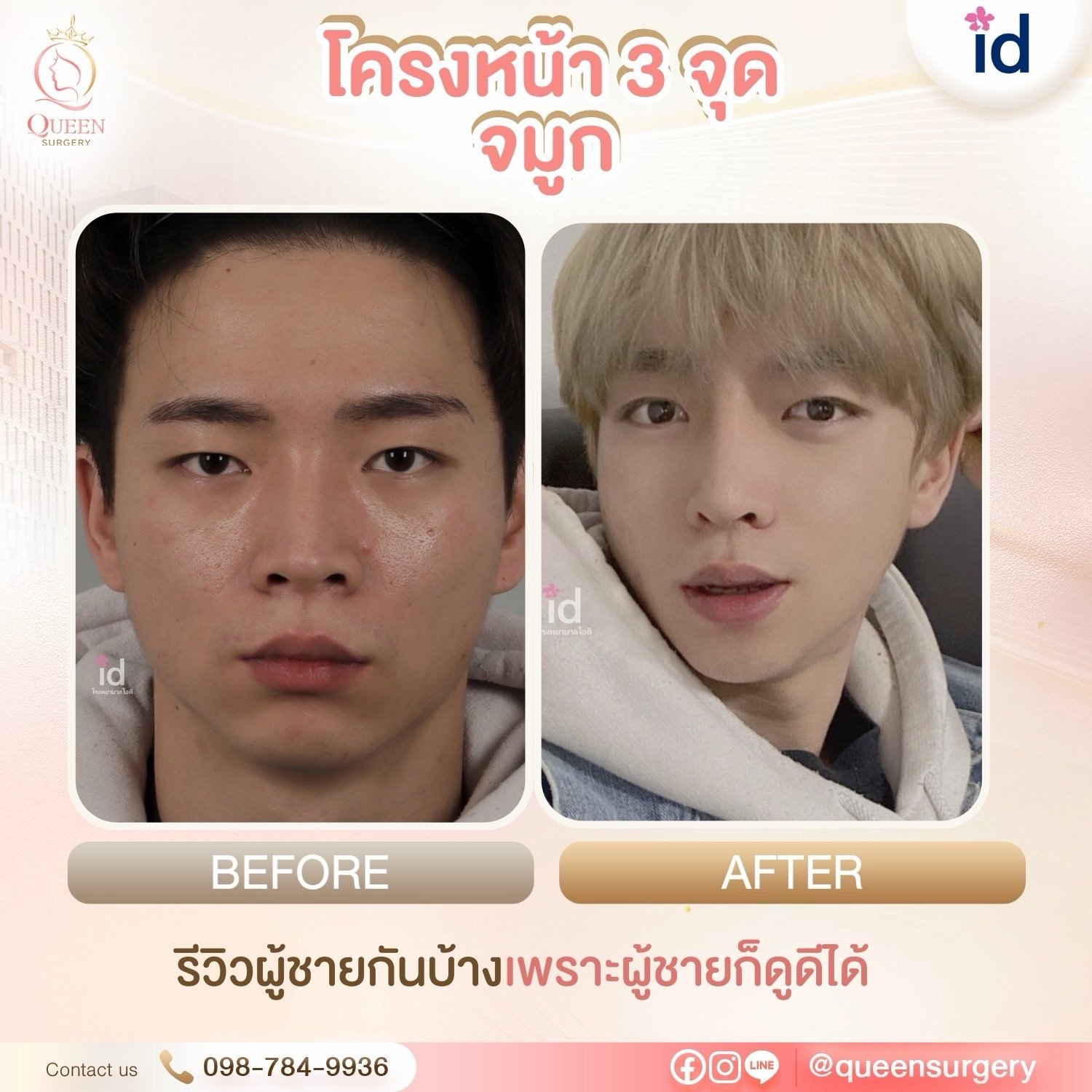 รีวิวการทำหน้าที่เกาหลี ปรับรูปหน้าและย้อนวัยสวยละมุนแบบธรรมชาติ