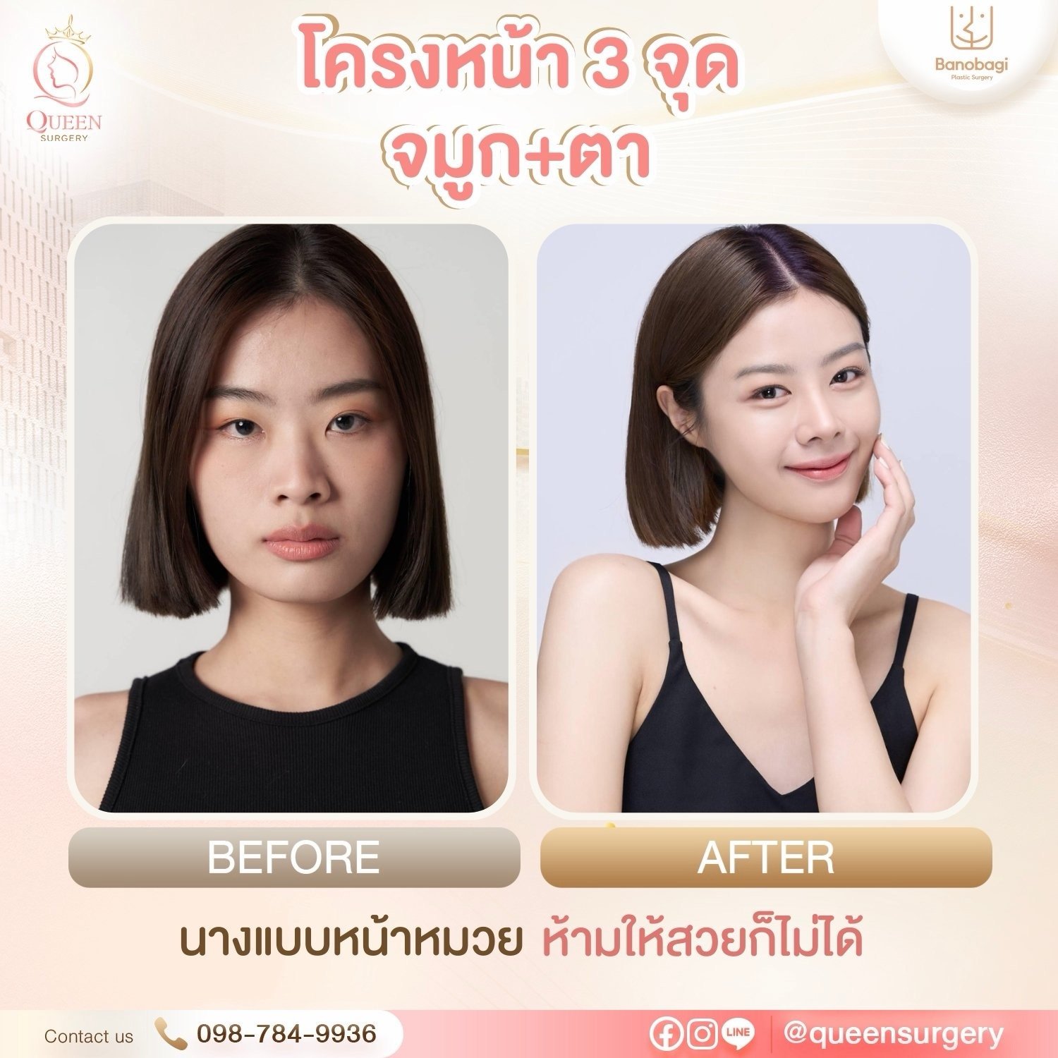 รีวิวการทำหน้าที่เกาหลี ปรับรูปหน้าและย้อนวัยสวยละมุนแบบธรรมชาติ