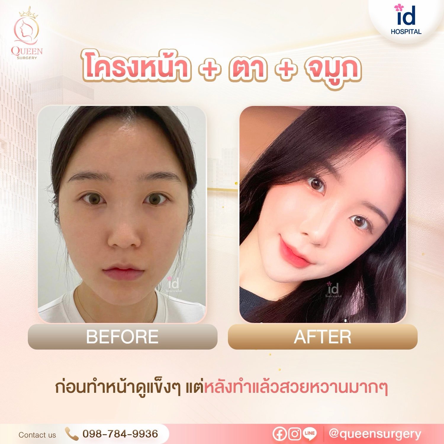 รีวิวการทำหน้าที่เกาหลี ปรับรูปหน้าและย้อนวัยสวยละมุนแบบธรรมชาติ