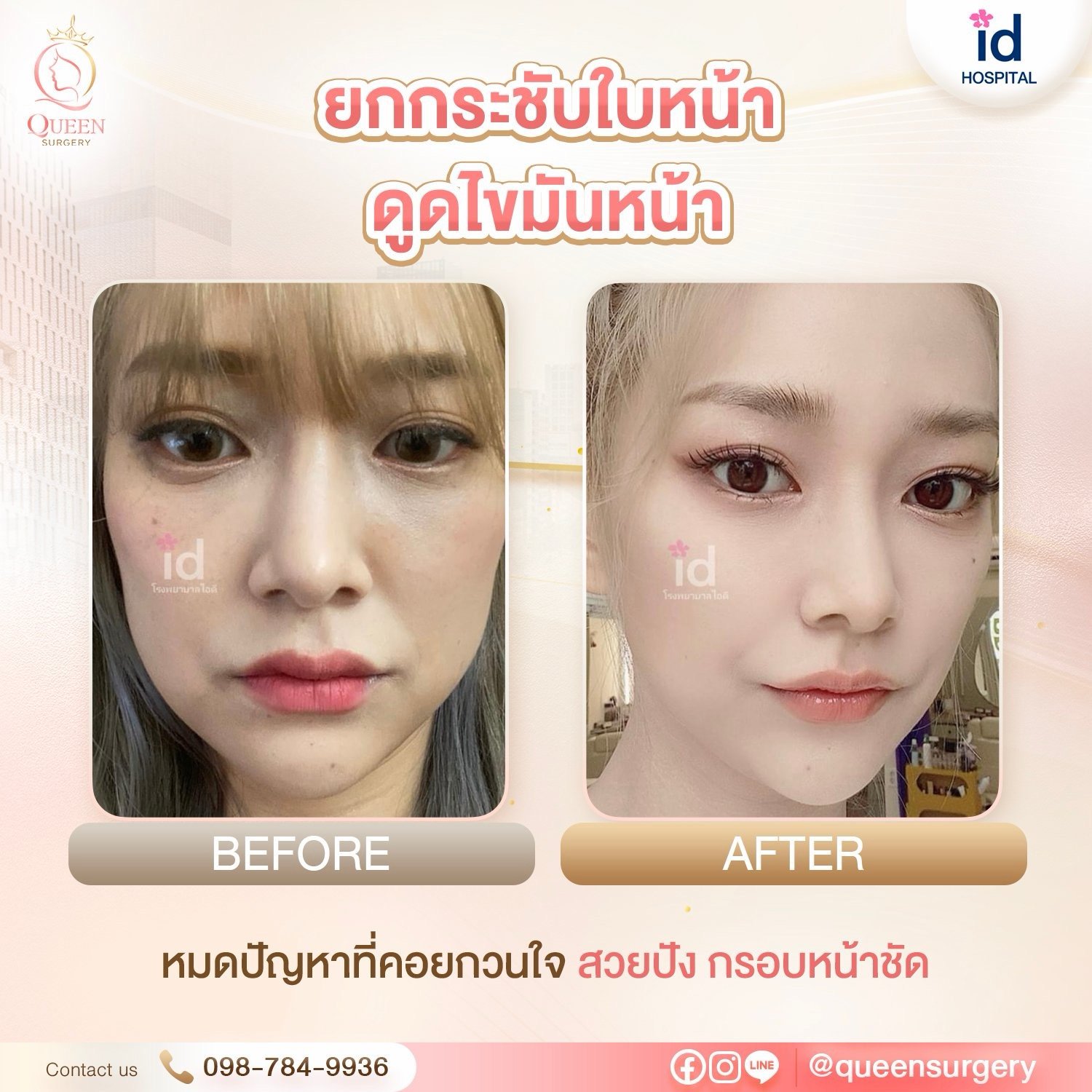 รีวิวการทำหน้าที่เกาหลี ปรับรูปหน้าและย้อนวัยสวยละมุนแบบธรรมชาติ