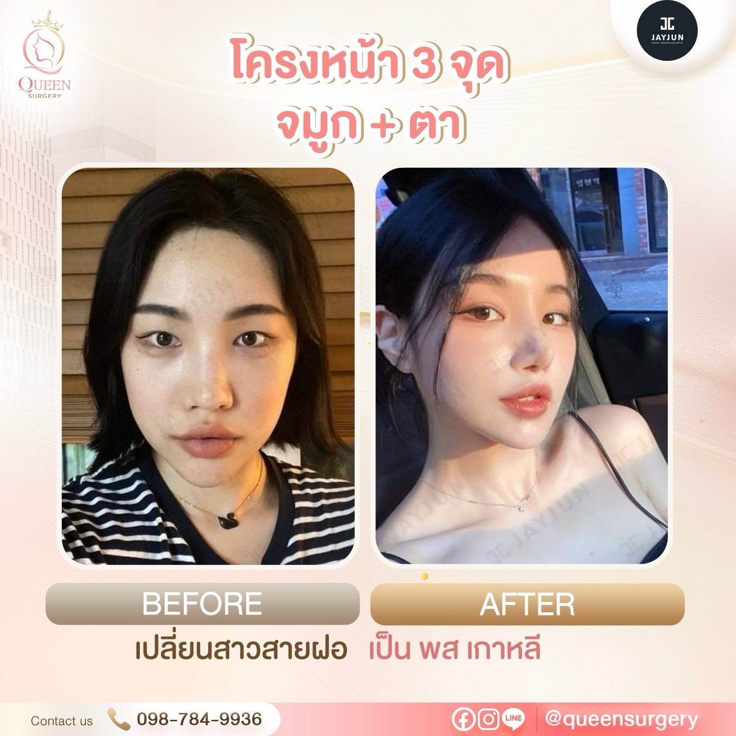 รีวิวการทำหน้าที่เกาหลี ปรับรูปหน้าและย้อนวัยสวยละมุนแบบธรรมชาติ