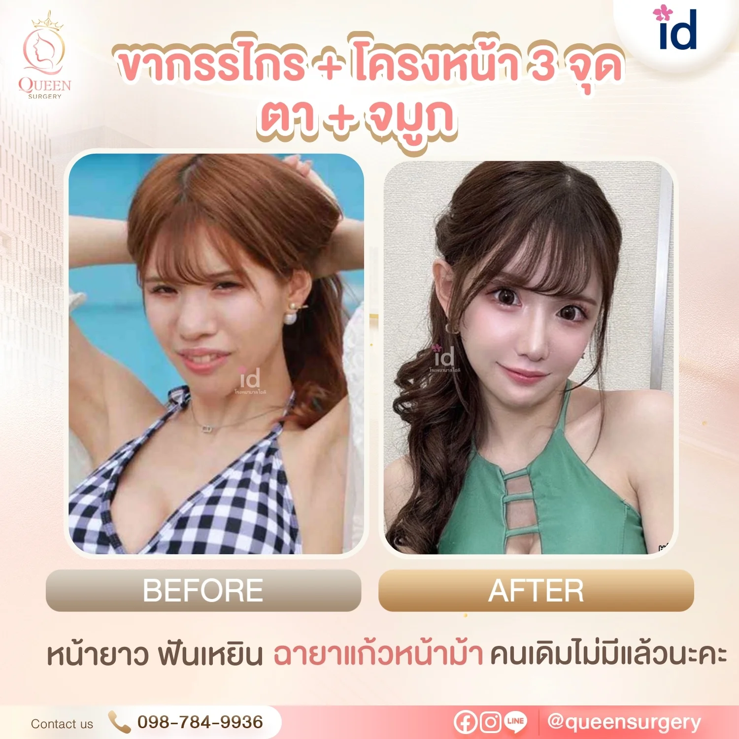 ศัลยกรรมขากรรไกร